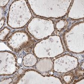 Anti-KYAT3 antibody produced in rabbit Prestige Antibodies&#174; Powered by Atlas Antibodies, affinity isolated antibody, buffered aqueous glycerol solution, Ab2