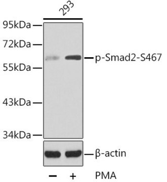 Anti-Phospho-Smad2-S467 antibody produced in rabbit