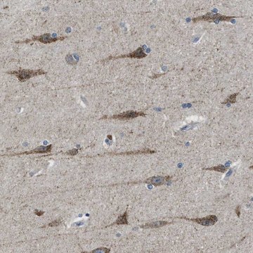 Anti-PAFAH2 antibody produced in rabbit Prestige Antibodies&#174; Powered by Atlas Antibodies, affinity isolated antibody, buffered aqueous glycerol solution