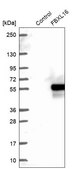 Anti-FBXL16 antibody produced in rabbit Prestige Antibodies&#174; Powered by Atlas Antibodies, affinity isolated antibody, buffered aqueous glycerol solution