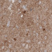 Monoclonal Anti-GAD1 antibody produced in mouse Prestige Antibodies&#174; Powered by Atlas Antibodies, clone CL2919, purified immunoglobulin, buffered aqueous glycerol solution