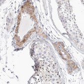 Anti-STAB2 antibody produced in rabbit Prestige Antibodies&#174; Powered by Atlas Antibodies, affinity isolated antibody, buffered aqueous glycerol solution