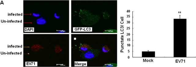 Anti-Enterovirus 71 Antibody, cross-reacts with Coxsackie A16, clone 422-8D-4C-4D ascites fluid, clone 422-8D-4C-4D, Chemicon&#174;