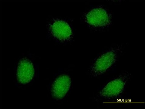 Anti-EXOSC1 antibody produced in mouse purified immunoglobulin, buffered aqueous solution