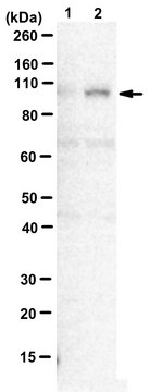 Anti-CDK11