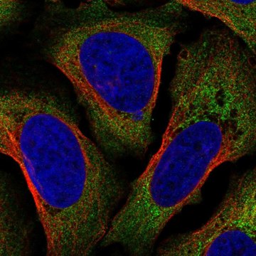 Anti-AIF1 antibody produced in rabbit Prestige Antibodies&#174; Powered by Atlas Antibodies, affinity isolated antibody