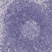 ANTI-NPTXR antibody produced in rabbit Prestige Antibodies&#174; Powered by Atlas Antibodies, affinity isolated antibody, buffered aqueous glycerol solution