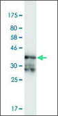 Monoclonal Anti-PRKAR2A, (N-terminal) antibody produced in mouse clone 3C7, purified immunoglobulin, buffered aqueous solution