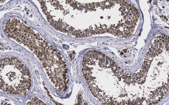 Anti-TSTA3 Antibody, clone 2N10-H1 ZooMAb&#174; Rabbit Monoclonal recombinant, expressed in HEK 293 cells