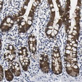 Anti-CASP6 antibody produced in rabbit Prestige Antibodies&#174; Powered by Atlas Antibodies, affinity isolated antibody, buffered aqueous glycerol solution