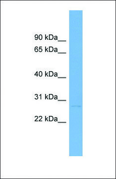 Anti-LTB antibody produced in rabbit affinity isolated antibody