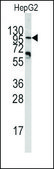 Anti-PYGM (center) antibody produced in rabbit Ig fraction of antiserum, buffered aqueous solution