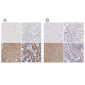 Anti-OTC antibody produced in rabbit Prestige Antibodies&#174; Powered by Atlas Antibodies, affinity isolated antibody, buffered aqueous glycerol solution