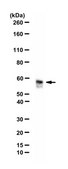 Anti-E3 ubiquitin-protein ligase UHRF2 Antibody from rabbit, purified by affinity chromatography