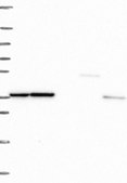 Anti-RPLP0 antibody produced in rabbit Prestige Antibodies&#174; Powered by Atlas Antibodies, affinity isolated antibody, buffered aqueous glycerol solution