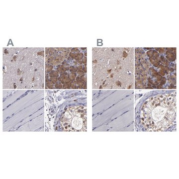 Anti-CARS antibody produced in rabbit Prestige Antibodies&#174; Powered by Atlas Antibodies, affinity isolated antibody, buffered aqueous glycerol solution