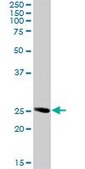 Anti-RAB32 antibody produced in rabbit purified immunoglobulin, buffered aqueous solution