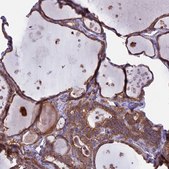 Anti-PTPN9 antibody produced in rabbit Prestige Antibodies&#174; Powered by Atlas Antibodies, affinity isolated antibody, buffered aqueous glycerol solution