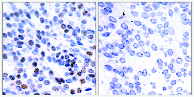 Anti-JUNB (Ab-259) antibody produced in rabbit affinity isolated antibody