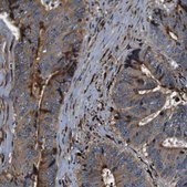 Anti-COL1A1 antibody produced in rabbit Prestige Antibodies&#174; Powered by Atlas Antibodies, affinity isolated antibody, buffered aqueous glycerol solution