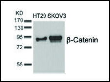Anti-CTNNB1 (Ab-37) antibody produced in rabbit affinity isolated antibody