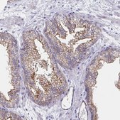 Anti-SSTR1 antibody produced in rabbit Prestige Antibodies&#174; Powered by Atlas Antibodies, affinity isolated antibody, buffered aqueous glycerol solution