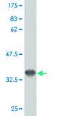 Monoclonal Anti-FLT4 antibody produced in mouse clone 5B5, purified immunoglobulin, buffered aqueous solution