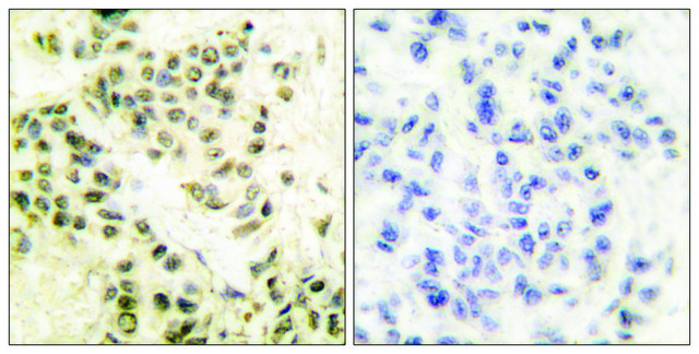 Anti-DNA-PK antibody produced in rabbit affinity isolated antibody