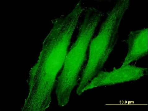 Anti-EXOSC1 antibody produced in mouse purified immunoglobulin, buffered aqueous solution