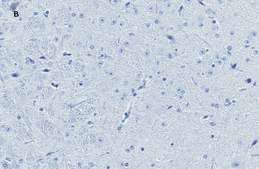 Anti-NeuN Antibody, clone 13E6, ZooMAb&#174; Rabbit Monoclonal recombinant, expressed in HEK 293 cells