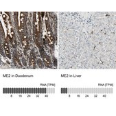 Anti-ME2 antibody produced in rabbit Prestige Antibodies&#174; Powered by Atlas Antibodies, affinity isolated antibody, buffered aqueous glycerol solution