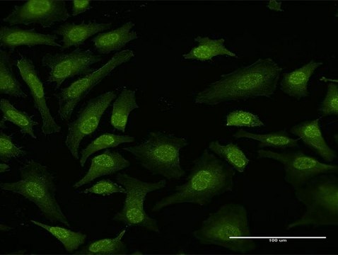 Anti-TPRKB antibody produced in rabbit purified immunoglobulin, buffered aqueous solution