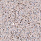 Monoclonal Anti-POSTN antibody produced in mouse Prestige Antibodies&#174; Powered by Atlas Antibodies, clone CL12087, purified immunoglobulin, buffered aqueous glycerol solution