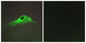 Anti-Collagen IV &#945;5 antibody produced in rabbit affinity isolated antibody