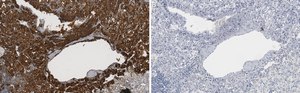 Anti-Clusterin &#945; chain Antibody, clone 41D ZooMAb&#174; Mouse Monoclonal recombinant, expressed in HEK 293 cells