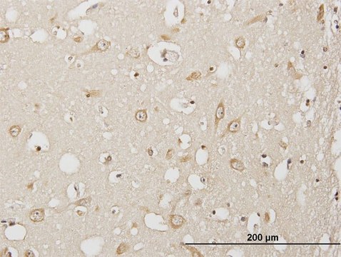 Anti-USP3 antibody produced in mouse purified immunoglobulin, buffered aqueous solution