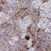 Anti-PNMT antibody produced in rabbit Prestige Antibodies&#174; Powered by Atlas Antibodies, affinity isolated antibody, buffered aqueous glycerol solution