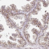 Anti-IDUA antibody produced in rabbit Prestige Antibodies&#174; Powered by Atlas Antibodies, affinity isolated antibody, buffered aqueous glycerol solution