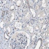 Anti-DCLK1 antibody produced in rabbit Prestige Antibodies&#174; Powered by Atlas Antibodies, affinity isolated antibody, buffered aqueous glycerol solution