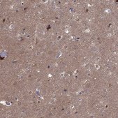 Anti-CDK5 antibody produced in rabbit Prestige Antibodies&#174; Powered by Atlas Antibodies, affinity isolated antibody