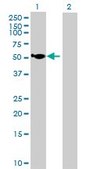 Anti-HGD antibody produced in mouse purified immunoglobulin, buffered aqueous solution