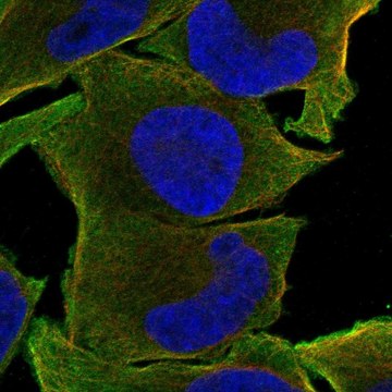 Anti-Crlf2 Antibody Produced In Rabbit Prestige Antibodies&#174; Powered by Atlas Antibodies, affinity isolated antibody, buffered aqueous glycerol solution