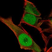 Anti-KLF6 antibody produced in rabbit Prestige Antibodies&#174; Powered by Atlas Antibodies, affinity isolated antibody
