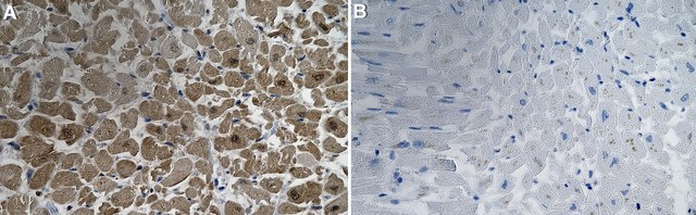 Anti-S100A1 Antibody, clone 1D18 ZooMAb&#174; Rabbit Monoclonal recombinant, expressed in HEK 293 cells