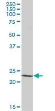 Anti-PCTP antibody produced in mouse purified immunoglobulin, buffered aqueous solution
