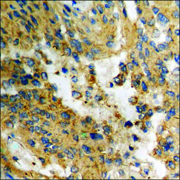 Anti-phospho-AKT1 (pThr308) antibody produced in rabbit affinity isolated antibody
