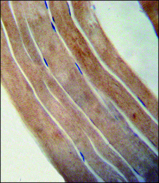 ANTI-EFTUD1 (C-TERM) antibody produced in rabbit IgG fraction of antiserum, buffered aqueous solution