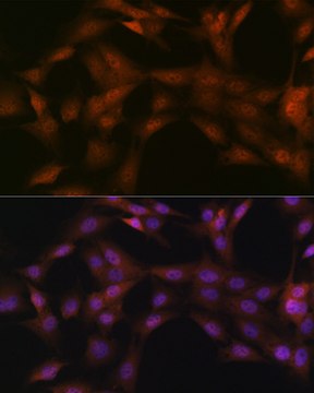 Anti-P23/PTGES3 Antibody, clone 10M9W8, Rabbit Monoclonal