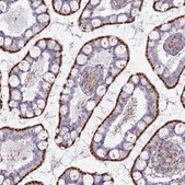 Anti-CHMP4B antibody produced in rabbit Prestige Antibodies&#174; Powered by Atlas Antibodies, affinity isolated antibody, buffered aqueous glycerol solution