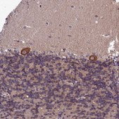 Anti-SLC39A6 antibody produced in rabbit Prestige Antibodies&#174; Powered by Atlas Antibodies, affinity isolated antibody, buffered aqueous glycerol solution